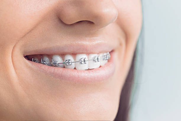 Laser Dentistry in Palos Park, IL